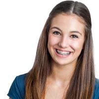 Orthodontics Image 4