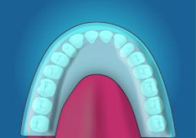 Somnowell Plastic Device Graphic 240